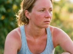 बढ़ती गर्मी में अपनी त्वचा को झुलसने से कैसे बचाएं? जानिए आसान टिप्स