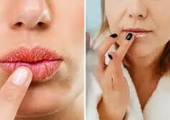 फटे होंठों के लिए घरेलू लिप जेल बनाने की विधि