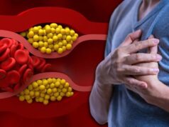 High Cholesterol: हाई कोलेस्ट्रॉल क्यों हो जाता है? ये गलतियां इसकी वजह बनती हैं