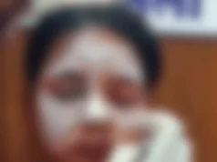 कॉलेज जाने के रास्ते में युवती पर एसिड अटैक, आरोपी वारदात के बाद फरार; पुलिस ने शुरू की तलाश